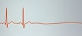 ECG in asystole, 3D illustration Royalty Free Stock Photo