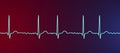 ECG in atrial fibrillation, 3D illustration