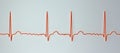 ECG in atrial fibrillation, 3D illustration