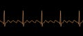 ECG in atrial flutter, 3D illustration