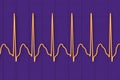 ECG in atrial flutter, 3D illustration