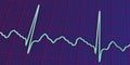 ECG in atrial flutter, 3D illustration