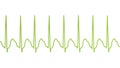 ECG in atrial flutter, 3D illustration