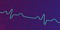 ECG of bundle branch block, 3D illustration Royalty Free Stock Photo