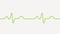 ECG of bundle branch block, 3D illustration Royalty Free Stock Photo