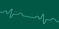 ECG of bundle branch block, 3D illustration Royalty Free Stock Photo