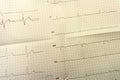 Ecg cardiology ecg analysis analyze beat,