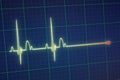 ECG / EKG monitor Royalty Free Stock Photo