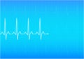 ECG Electrocardiogram, Royalty Free Stock Photo