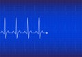 ECG Electrocardiogram, Royalty Free Stock Photo