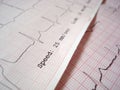 ECG electrocardiography