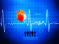 ECG Electrocardiography