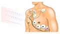 ECG electrodes on the chest of the athlete Royalty Free Stock Photo