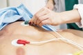 ECG electrodes on the patient Royalty Free Stock Photo