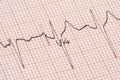 Ecg graph Royalty Free Stock Photo