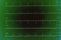 ECG graph