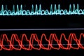 ECG graph on the monitor pixelated