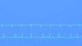 ECG graphs of regular and irregular atrial flutter