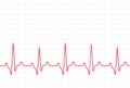 ECG heartbeat monitor, cardiogram heart pulse line wave. Electrocardiogram medical background Royalty Free Stock Photo