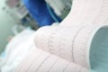 ECG interpretation in the intensive care Royalty Free Stock Photo