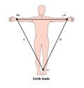 ECG limb leads