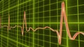 ECG line graph, heart beating in normal sinus rhythm, healthcare and medicine