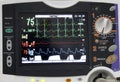 ECG monitor