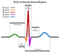 ECG of normal sinus rhythm infographic diagram