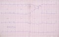 ECG real chart Royalty Free Stock Photo