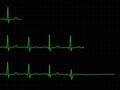 ECG set