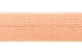 ECG test results on millimeter paper, heart rhythm results Royalty Free Stock Photo