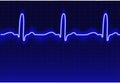 ECG trace