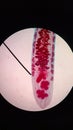Echinostoma ilocanum under the microscope Royalty Free Stock Photo