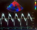 Echocardiogram colorful probe targeting map and waveforms