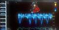 Echocardiogram colorful probe targeting map and waveforms
