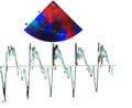 Echocardiogram colorful probe targeting map and waveforms - png