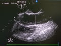 Echocardiography ultrasound machine.