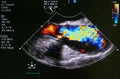 Echocardiography ultrasound machine.