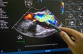 Echocardiography ultrasound machine.