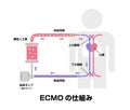 ECMO Extracorporeal membrane oxygenation structure vector illustration / Japanese