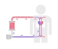 ECMO Extracorporeal membrane oxygenation structure vector illustration / no text