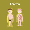 Eczema sick illustration with human body full stand and organ protection sign