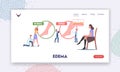 Edema Disease Landing Page Template. Tiny Doctor and Patient Characters at Huge Infographics Presenting Diseased Legs