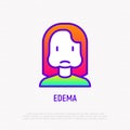 Edema thin line icon: woman with swollen cheeks