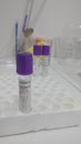 EDTA glass tube for research of fish blood to prevent coagulation