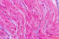 Histological sample Heart muscle Tissue under the microscope. Royalty Free Stock Photo