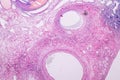 Histological sample Ovary of rabbit Tissue under the microscope.