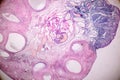 Histological sample Ovary of rabbit Tissue under the microscope. Royalty Free Stock Photo