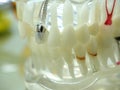 Education human dental model, transparent demonstration of teeth implantation and nerves, on a table close up
