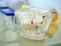 Education human dental model, transparent demonstration of teeth implantation and nerves, on a table close up, partially defocused